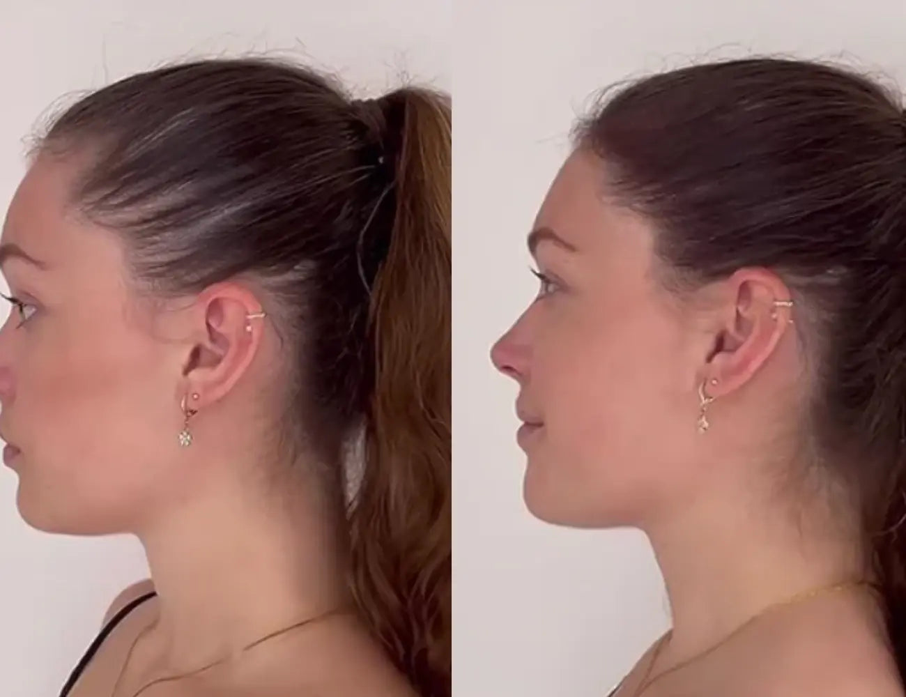 Lustrao Hair Growth Trio Lustrao
