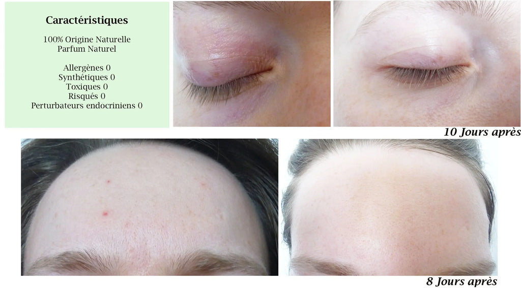 MERVEILLE DES LANDES BIO - Soin de peau Sensible Régénération Intégrale Visage Beauté & Cosmétiques
