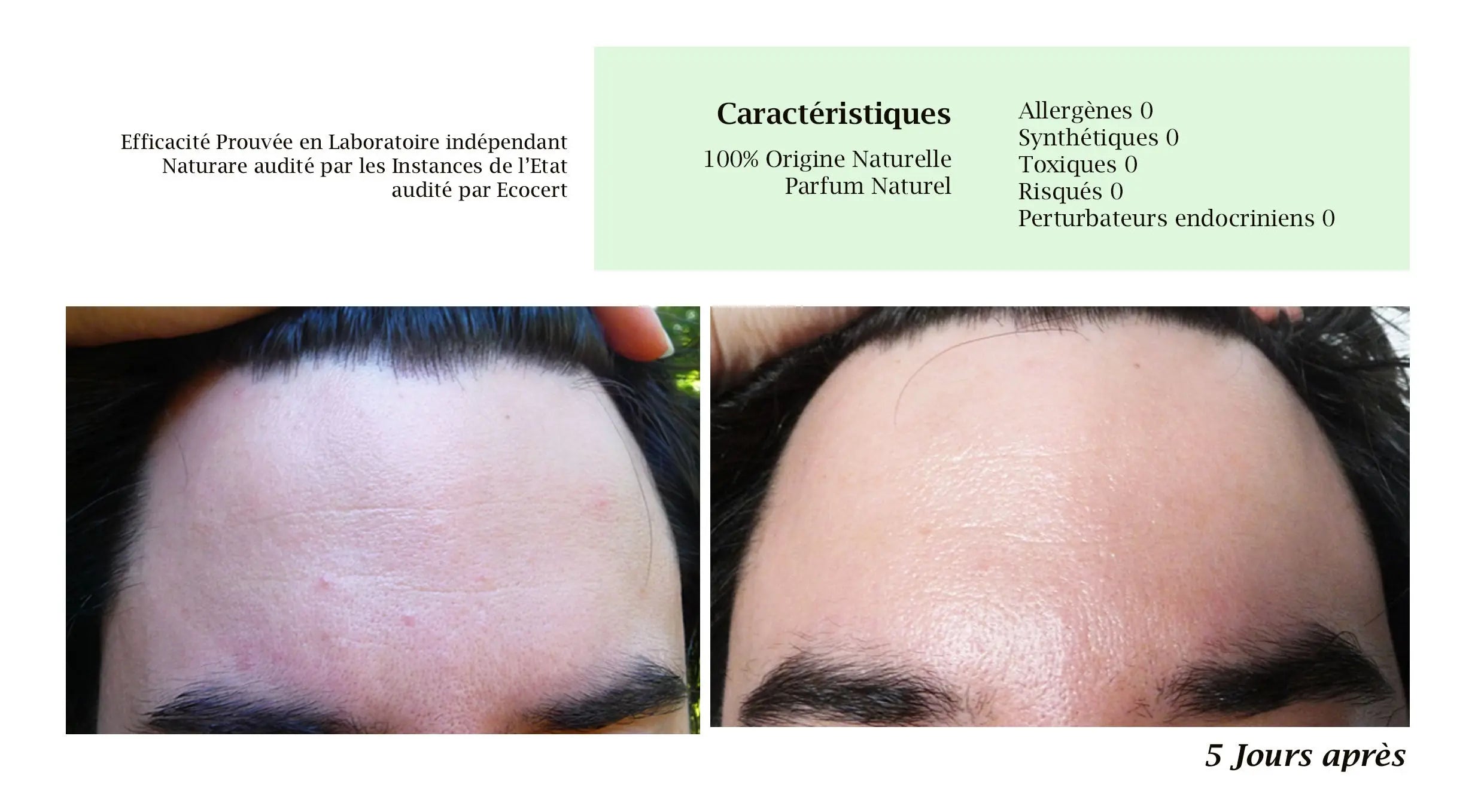 MERVEILLE DES LANDES BIO - Soin de peau Sensible Régénération Intégrale Visage Beauté & Cosmétiques