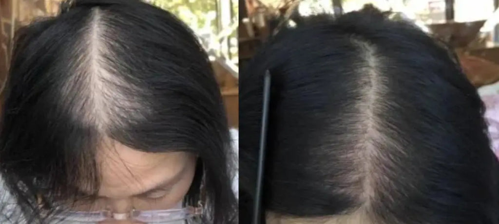Lustrao Hair Growth Trio Lustrao