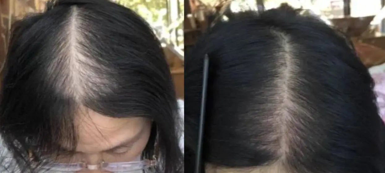 Lustrao Hair Growth Trio Lustrao