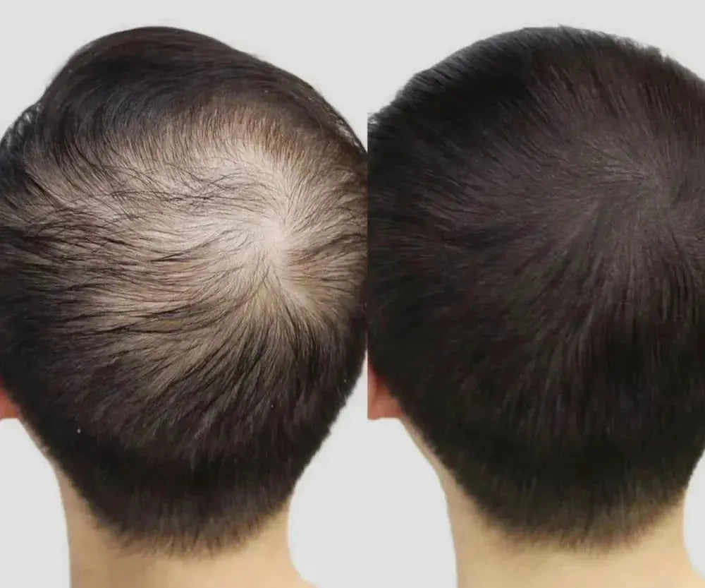 Lustrao Hair Growth Trio Lustrao